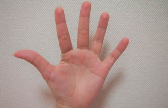 指が太くなる原因は5つ 細くすることはできる 防ぐ対策は 楽しい生活日和